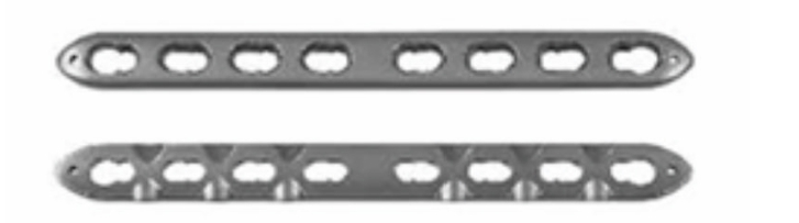 Блокуюча пластина для велигомілкової кістки UMP